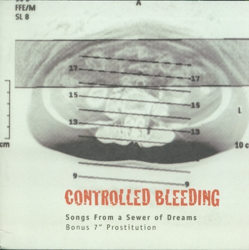 Controlled Bleeding - Songs From A Sewer Of Dreams (4LP+7"/Vinyl Box)