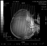 Barrikad / Hydra And Death Squad - Entropic Society / Neurology 2 (10")